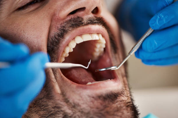 Best Urgent Care for Lost Fillings or Crowns in Washington, NC